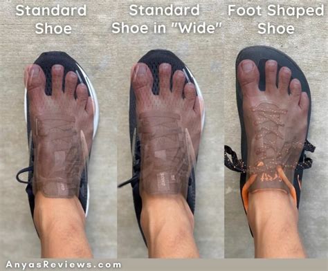 <b>For</b> men: Vionic Men's Walker - Dress <b>shoe</b> <b>for</b> Charcot foot patients. . Custom made shoes for wide feet